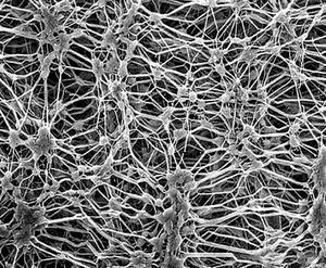 why is pvdf membrane activated by methanol, activate pvdf membrane methanol, pvdf membrane activatio